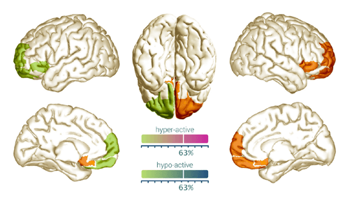 Network activity in a brain scan