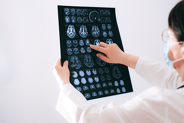 A doctor pointing at a brain scan result