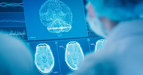 Brain mapping software